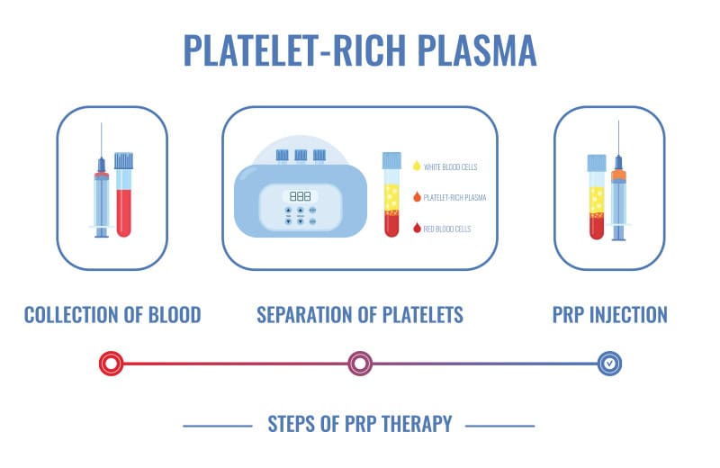 Precision Cosmetics PRP treatment Tucson