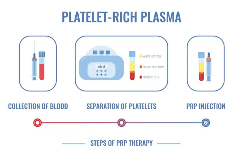 Precision Cosmetics PRP treatment Tucson