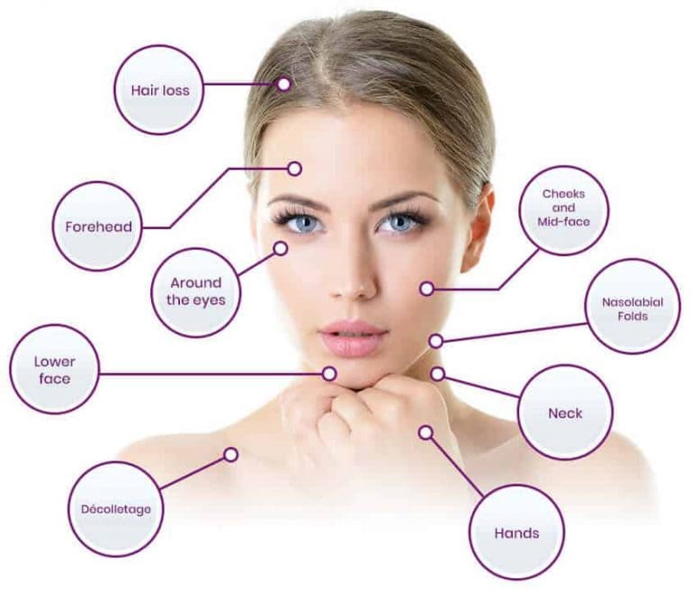 PRP treatment results Tucson