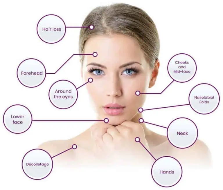 PRP treatment results Tucson