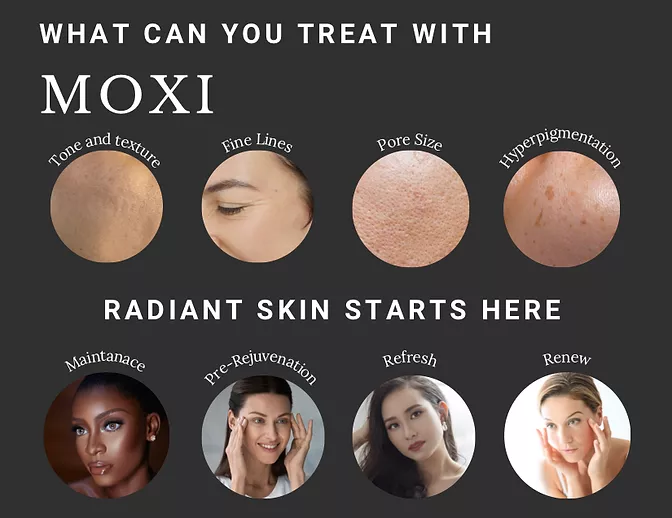 Precision Cosmetics MOXI laser therapy Tucson